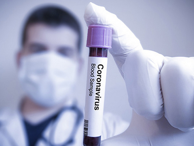 Узнай, о каких опасных последствиях коронавируса предупредили медики