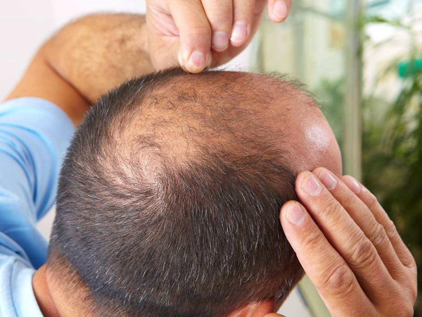 Боремся с облысением и  сединой: 6 ошибок, которые  могут стоить тебе волос