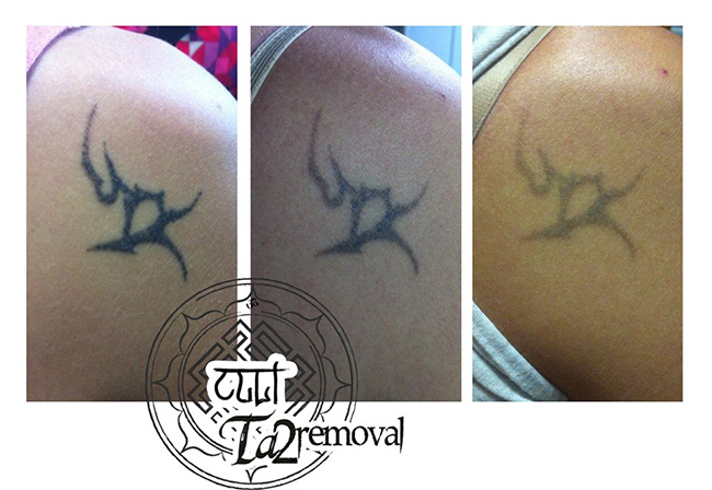 Cult Ta2removal