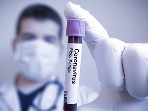 Узнай, о каких опасных последствиях коронавируса предупредили медики
