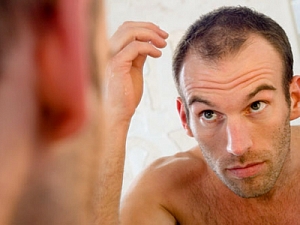 Выпадение волос у мужчин: коротко о главном
