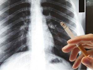 Как курильщики могут избежать рака легких